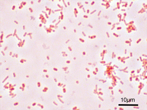 Mikrobiologia - Salmonella1.jpg